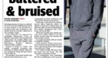 Perth lollipop man left battered and bruised