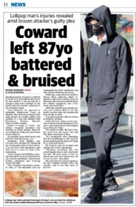 Perth lollipop man left battered and bruised